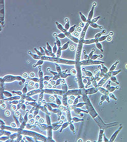 Trichoderma asperellum vs. Other Trichoderma Species in Farming